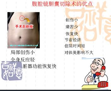 腹腔鏡膽囊切除術(shù)治療膽囊結(jié)石